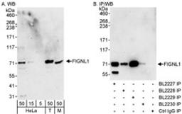 Detection of human and mouse FIGNL1 by western blot (h&m) and immunoprecipitation (h).