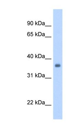 Western Blot: gamma Sarcoglycan Antibody [NBP1-59744] - Human Heart lysate, concentration 1.25ug/ml.