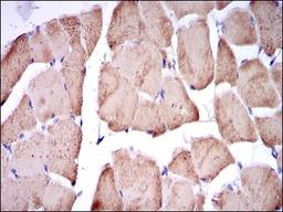 Immunohistochemistry: Troponin I type 2 (fast skeletal) Antibody (2F12A11) [NBP2-37551] - Immunohistochemical analysis of paraffin-embedded striated muscle tissues using TNNI2 mouse mAb with DAB staining.