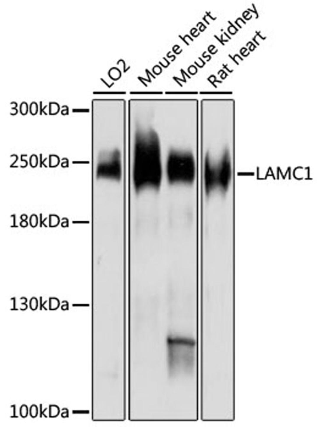 Western blot - LAMC1 antibody (A16020)