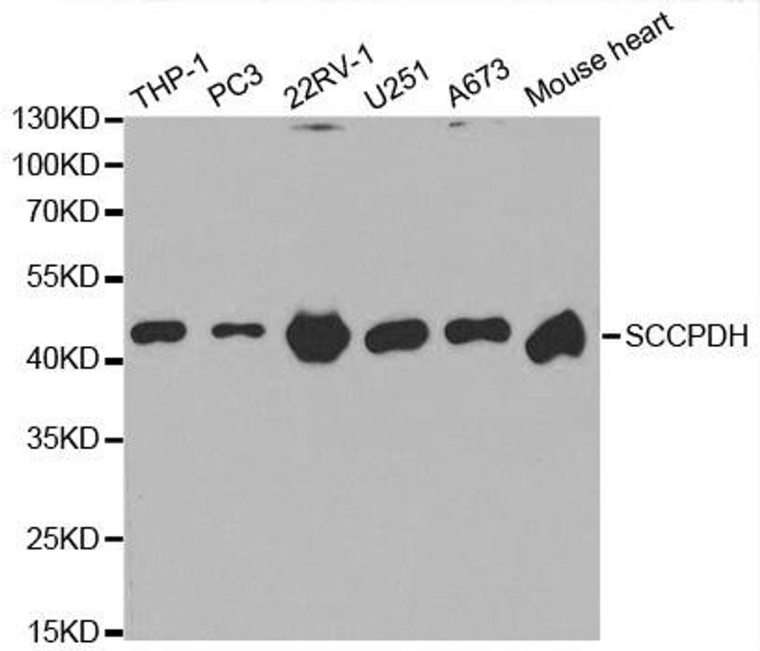 Western blot analysis of extracts of various cell lines using SCCPDH antibody