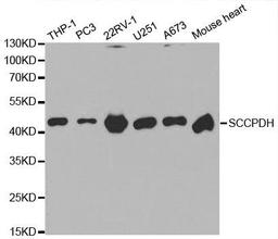 Western blot analysis of extracts of various cell lines using SCCPDH antibody