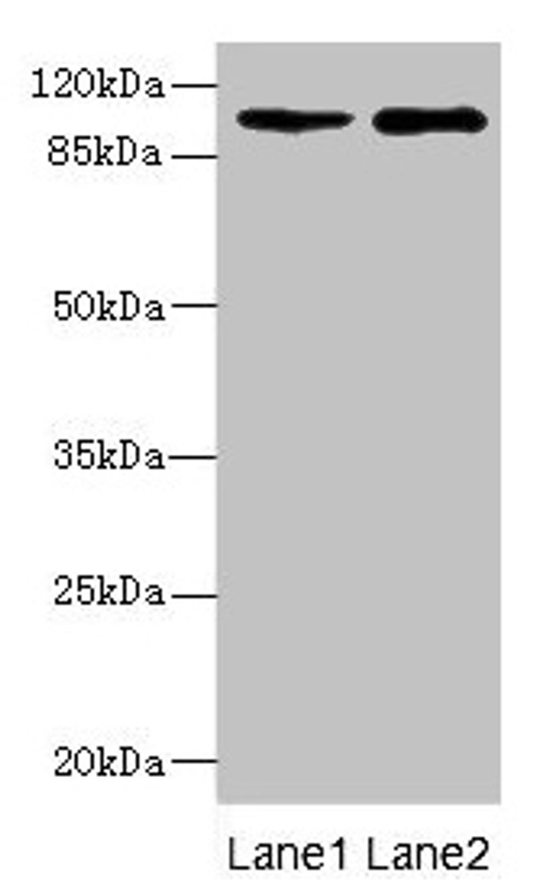 Western blot. All lanes: GRIK3 antibody at 1.45µg/ml. Lane 1: Hela whole cell lysate. Lane 2: K562 whole cell lysate. Secondary. Goat polyclonal to rabbit IgG at 1/10000 dilution. Predicted band size: 105, 99 kDa. Observed band size: 105 kDa