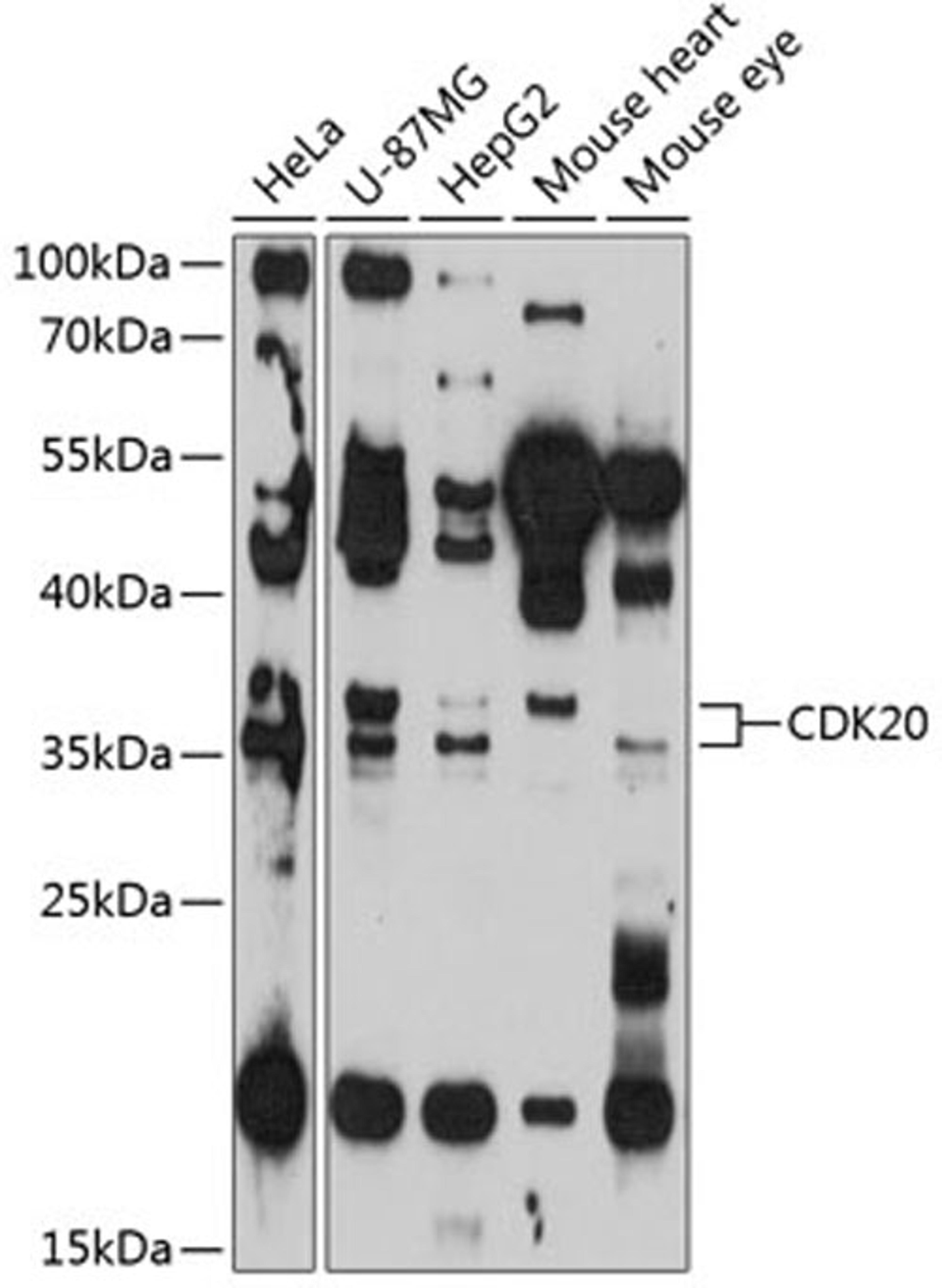 Western blot - CDK20 antibody (A11599)