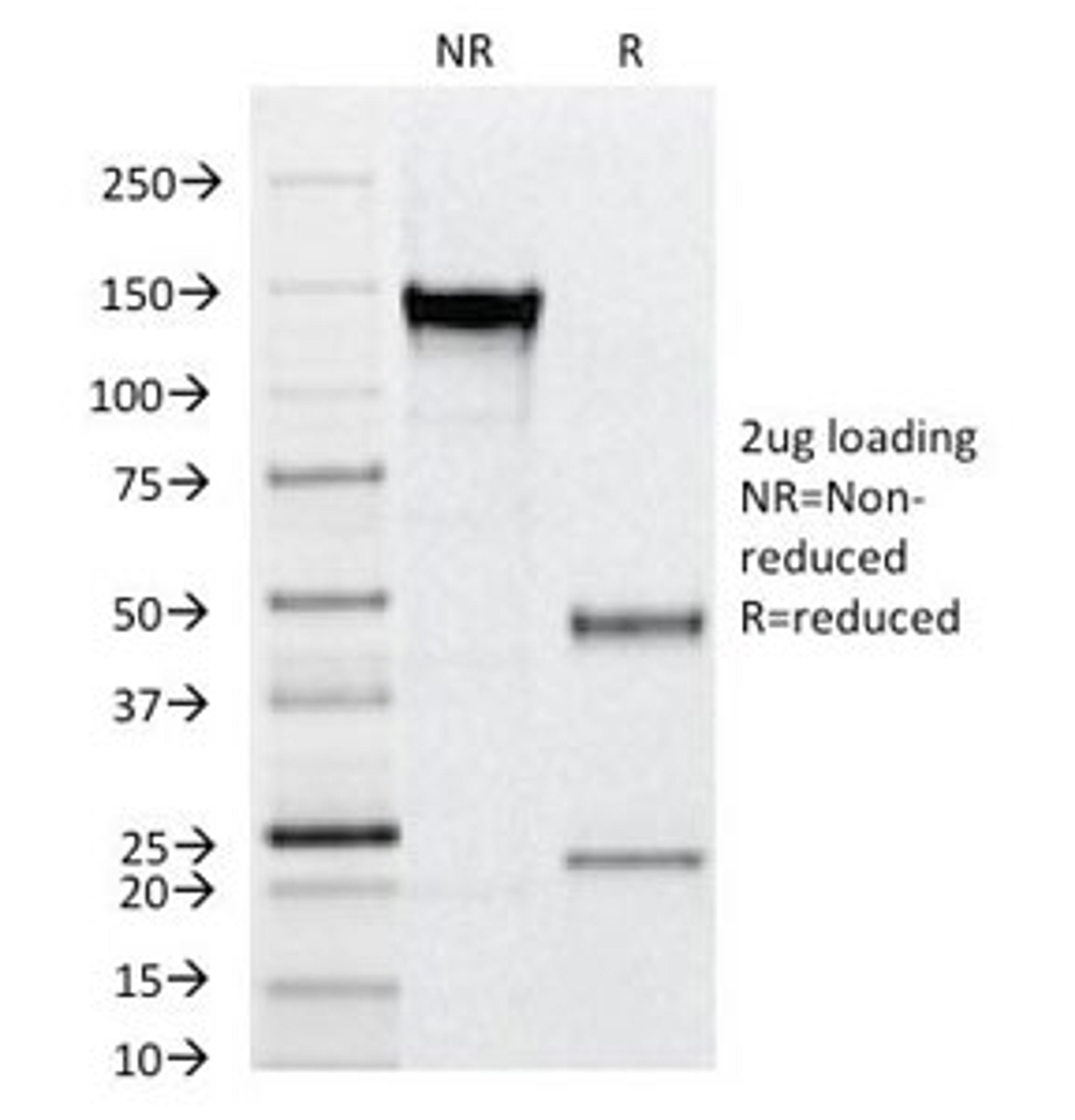 SDS-PAGE Analysis of Purified, BSA-Free CD31 Antibody (clone C31.12). Confirmation of Integrity and Purity of the Antibody.