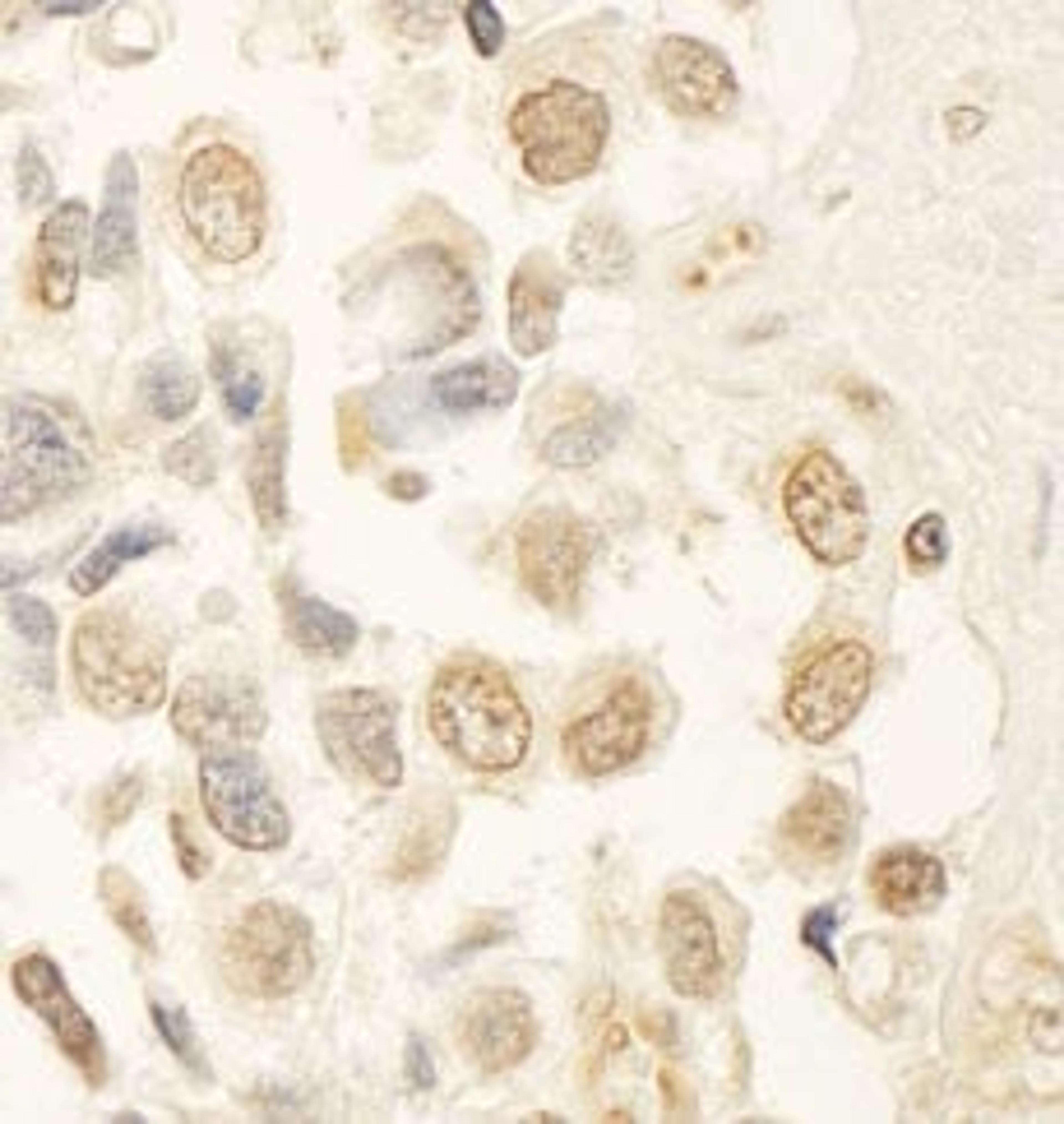 Detection of human HBO by immunohistochemistry.