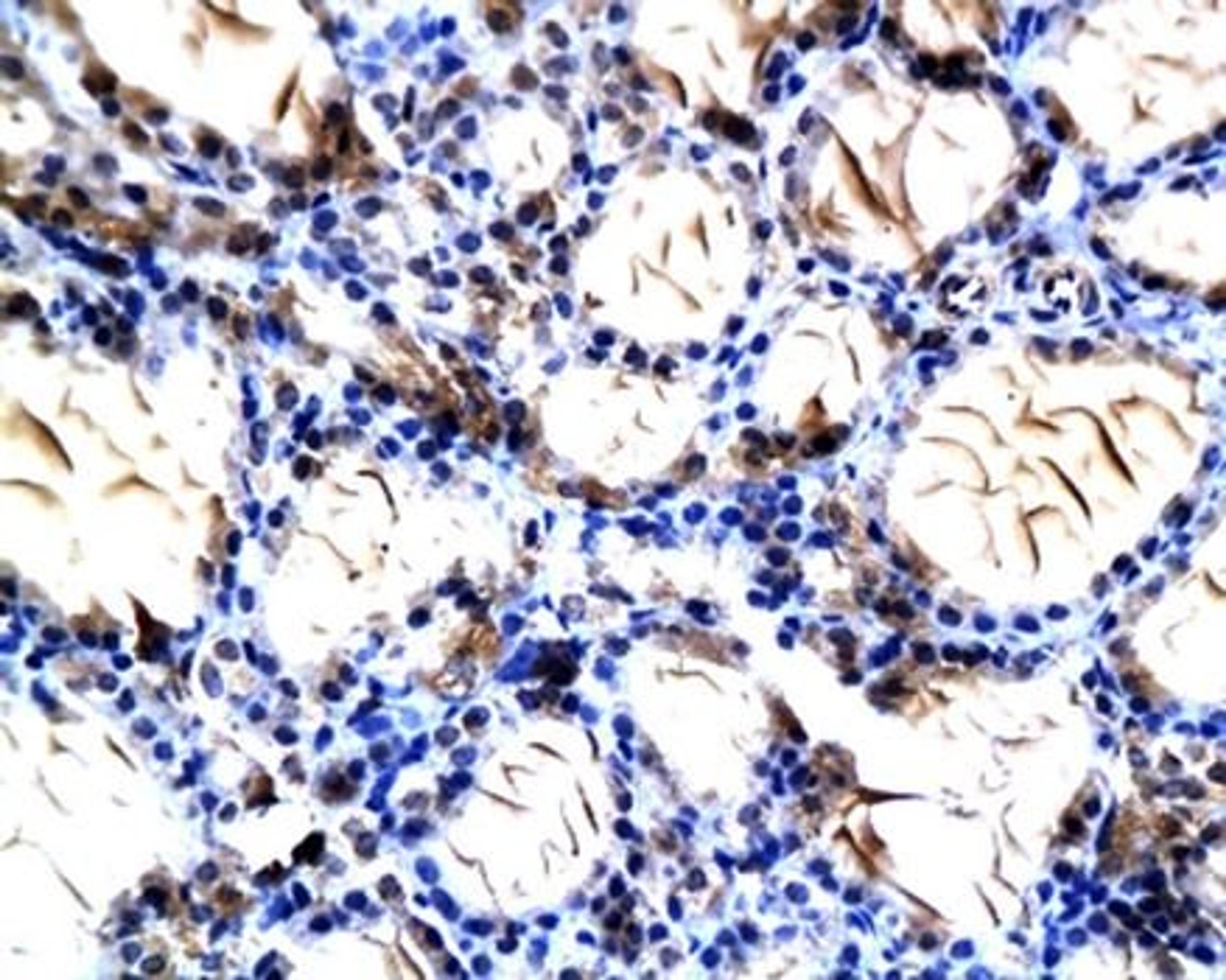 Immunohistochemical analysis of paraffin-embedded thyroid gland tissue in rat using NIS antibody 