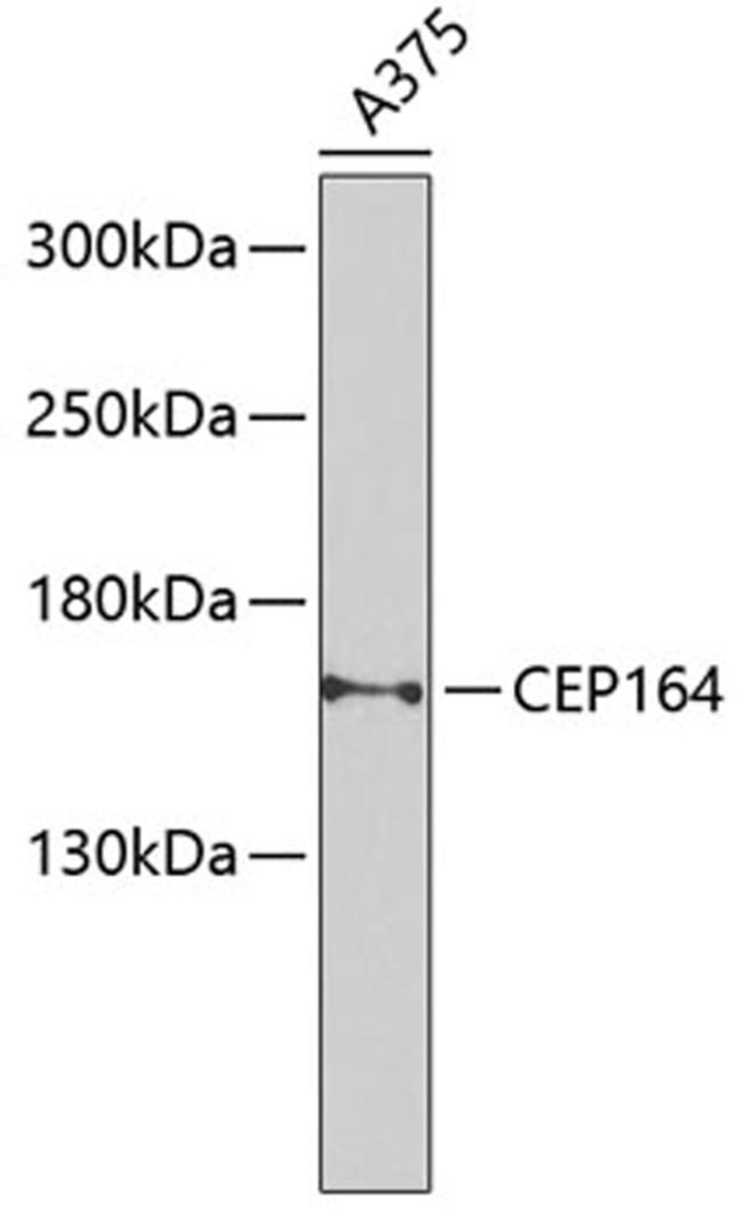 Western blot - CEP164 Antibody (A9964)