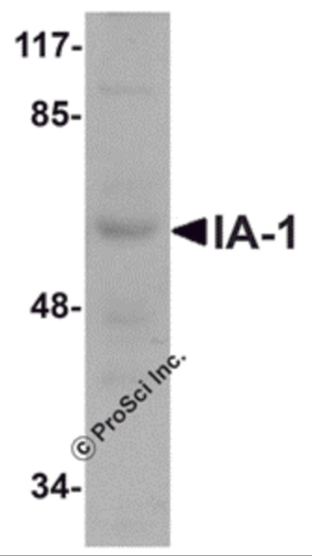 Western blot analysis of IA-1 in rat thymus tissue lysate with IA-1 antibody at 1 μg/mL.