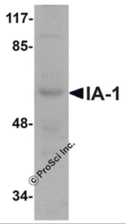 Western blot analysis of IA-1 in rat thymus tissue lysate with IA-1 antibody at 1 μg/mL.