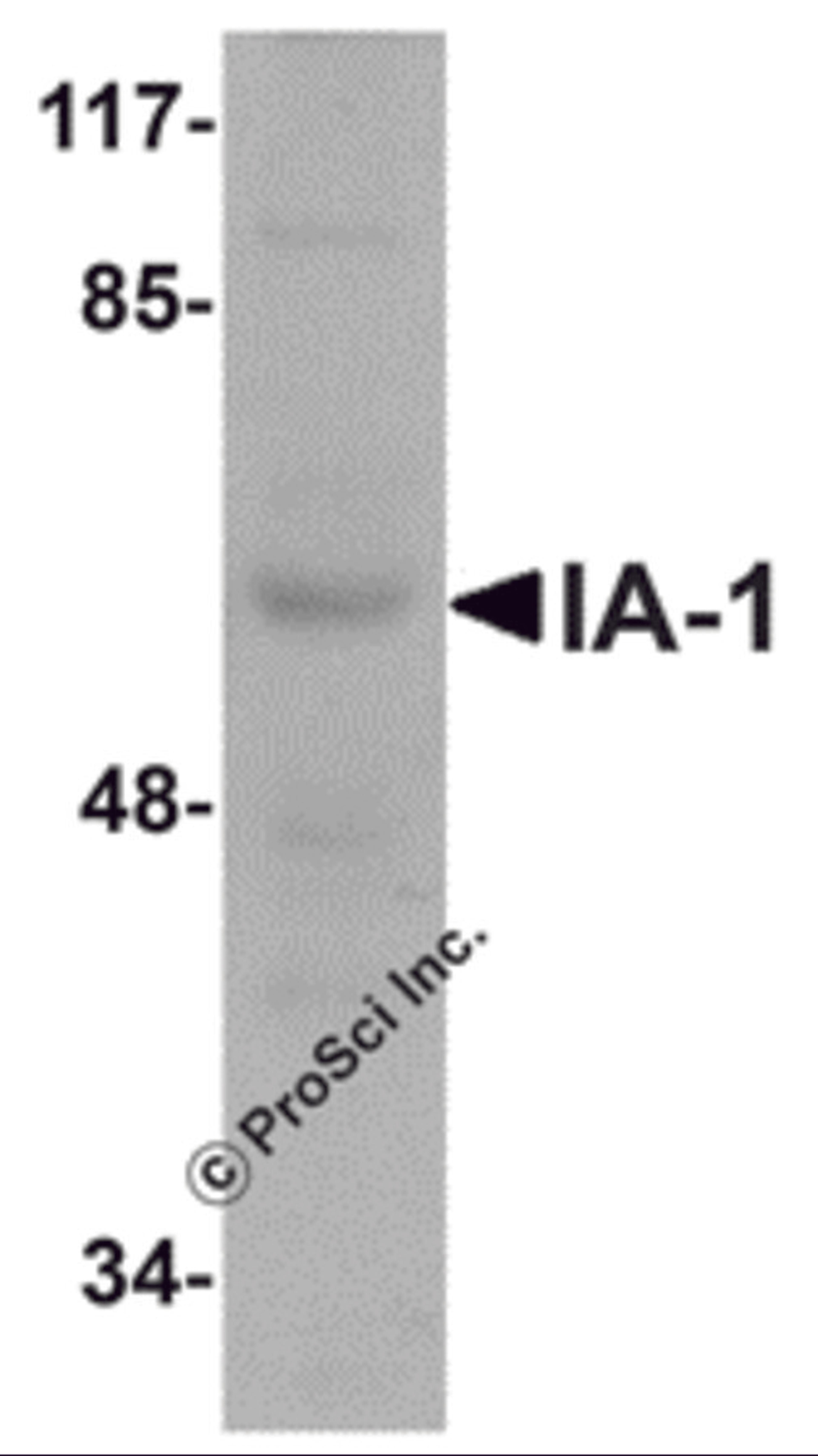 Western blot analysis of IA-1 in rat thymus tissue lysate with IA-1 antibody at 1 μg/mL.