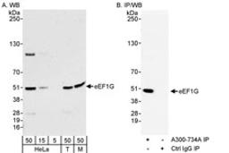 Detection of human and mouse eEF1G by western blot (h&m) and immunoprecipitation (h).