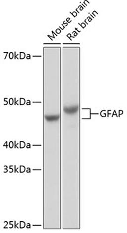 Western blot - GFAP antibody (A19058)