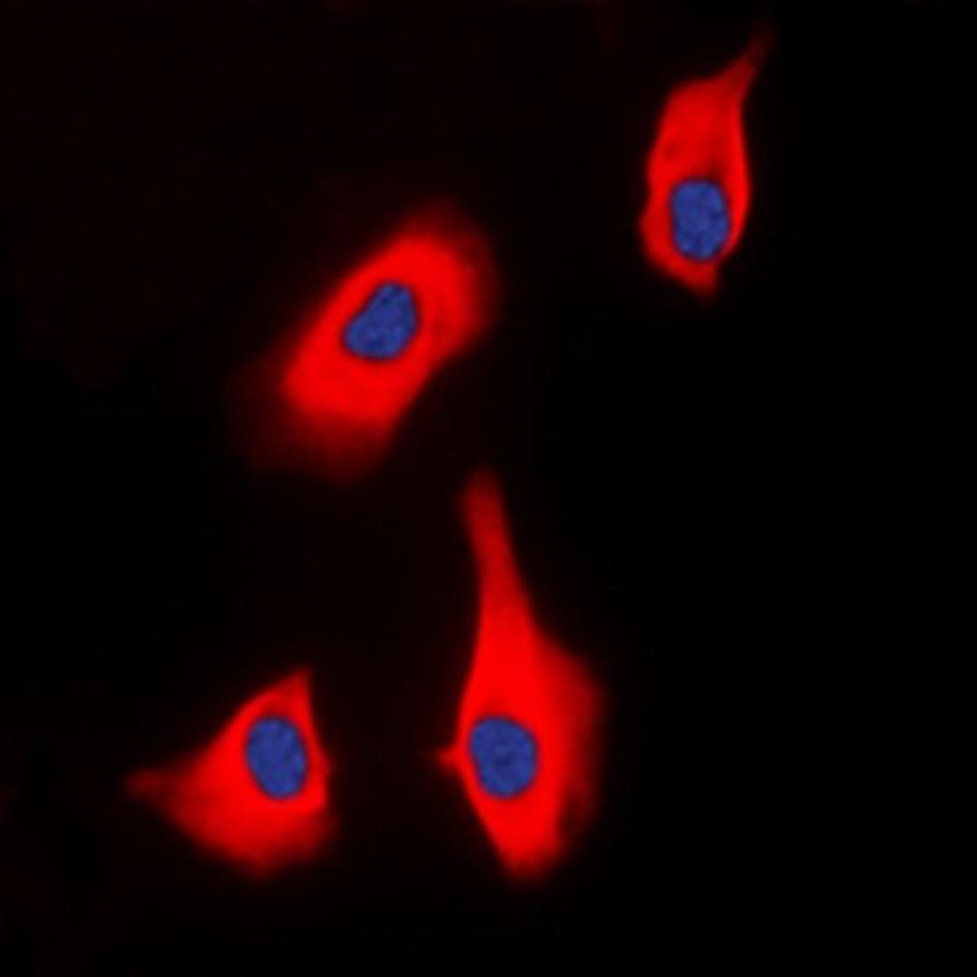 Immunofluorescense analysis of HEK293T cells using PTHR1 antibody