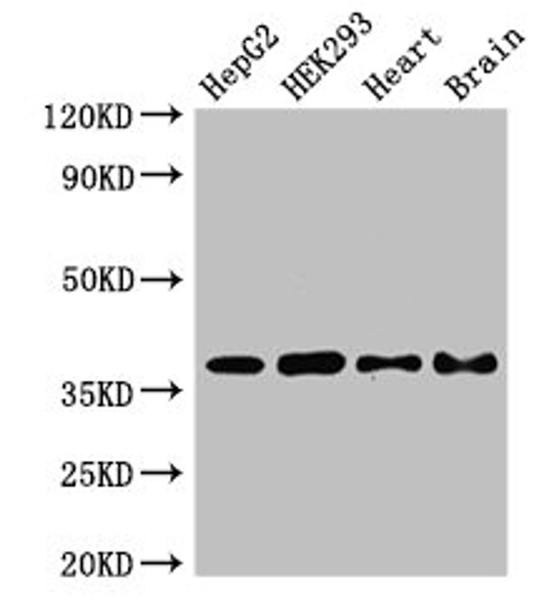Western Blot. Positive WB detected in: HepG2 whole cell lysate, HEK293 whole cell lysate, Mouse heart tissue, Mouse brain tissue. All lanes: PNKD antibody at 2.8µg/ml. Secondary. Goat polyclonal to rabbit IgG at 1/50000 dilution. Predicted band size: 43, 16, 41, 37 kDa. Observed band size: 37 kDa