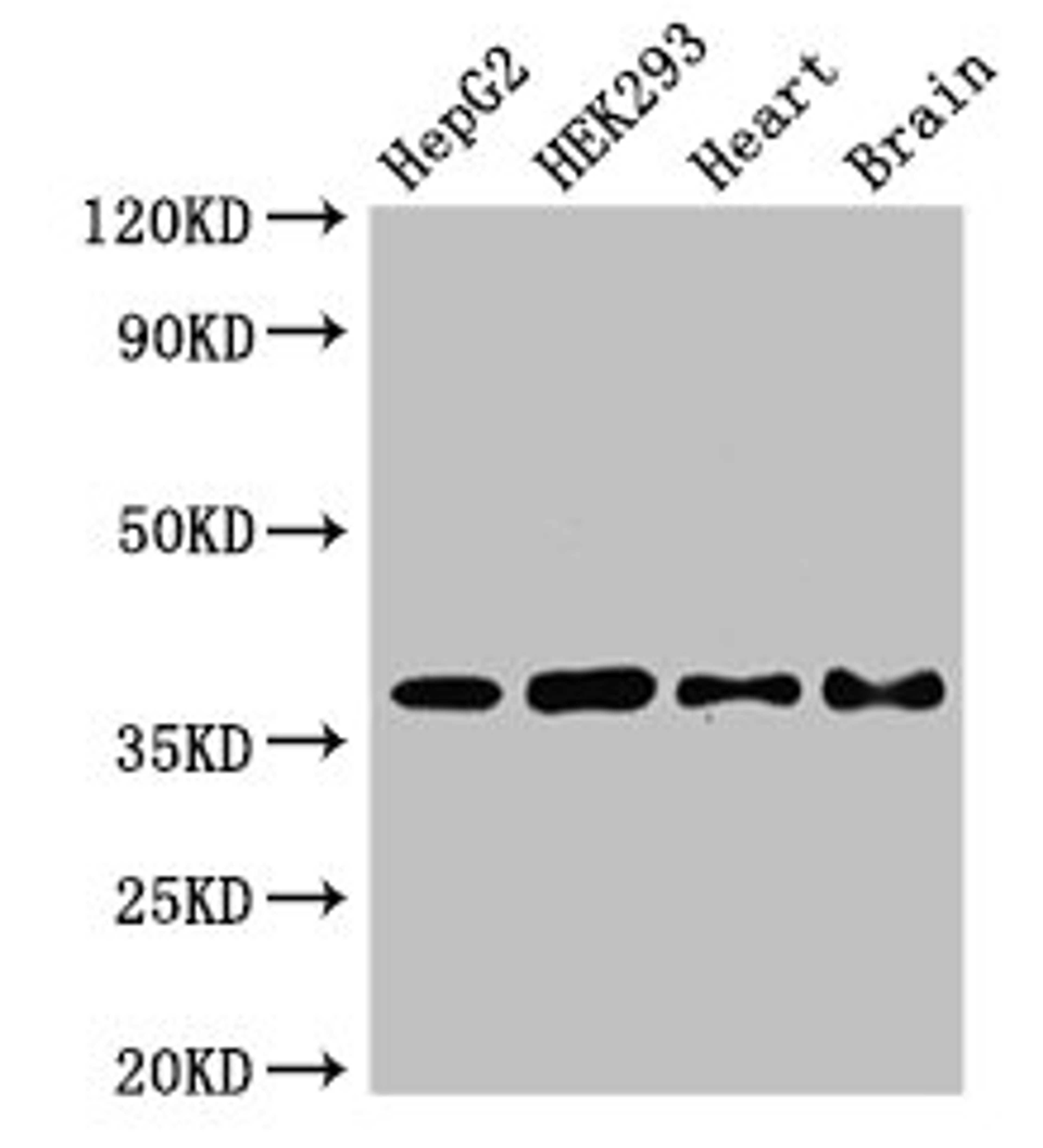 Western Blot. Positive WB detected in: HepG2 whole cell lysate, HEK293 whole cell lysate, Mouse heart tissue, Mouse brain tissue. All lanes: PNKD antibody at 2.8µg/ml. Secondary. Goat polyclonal to rabbit IgG at 1/50000 dilution. Predicted band size: 43, 16, 41, 37 kDa. Observed band size: 37 kDa