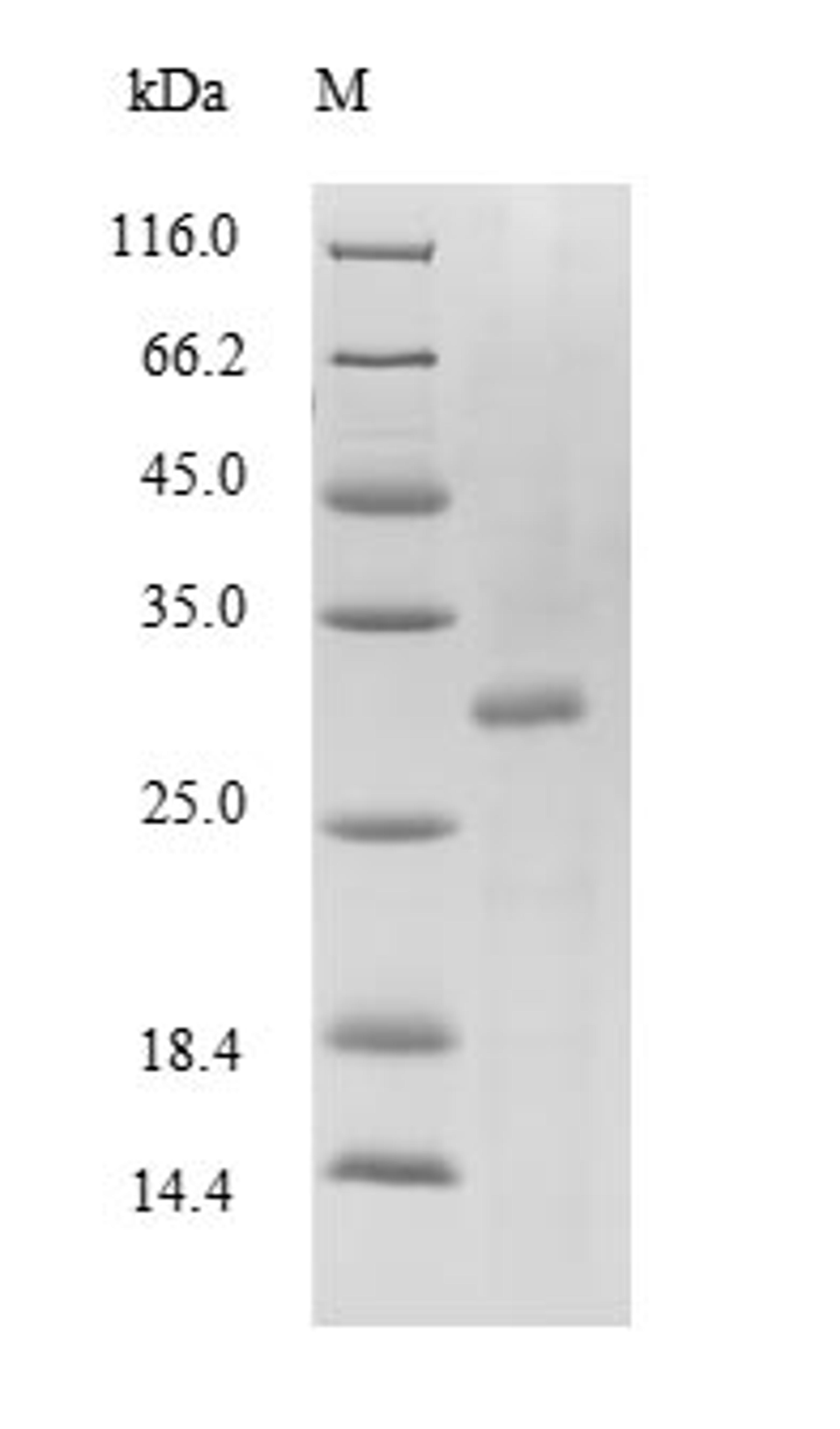 (Tris-Glycine gel) Discontinuous SDS-PAGE (reduced) with 5% enrichment gel and 15% separation gel.