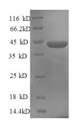 (Tris-Glycine gel) Discontinuous SDS-PAGE (reduced) with 5% enrichment gel and 15% separation gel.
