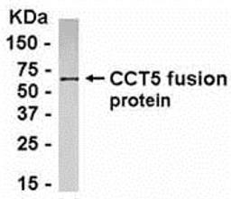 E coli-derived fusion protein as test antigen. Affinity-purified IgY dilution: 1:2000, Goat anti-IgY-HRP dilution: 1:1000. Colorimetric method for signal development.