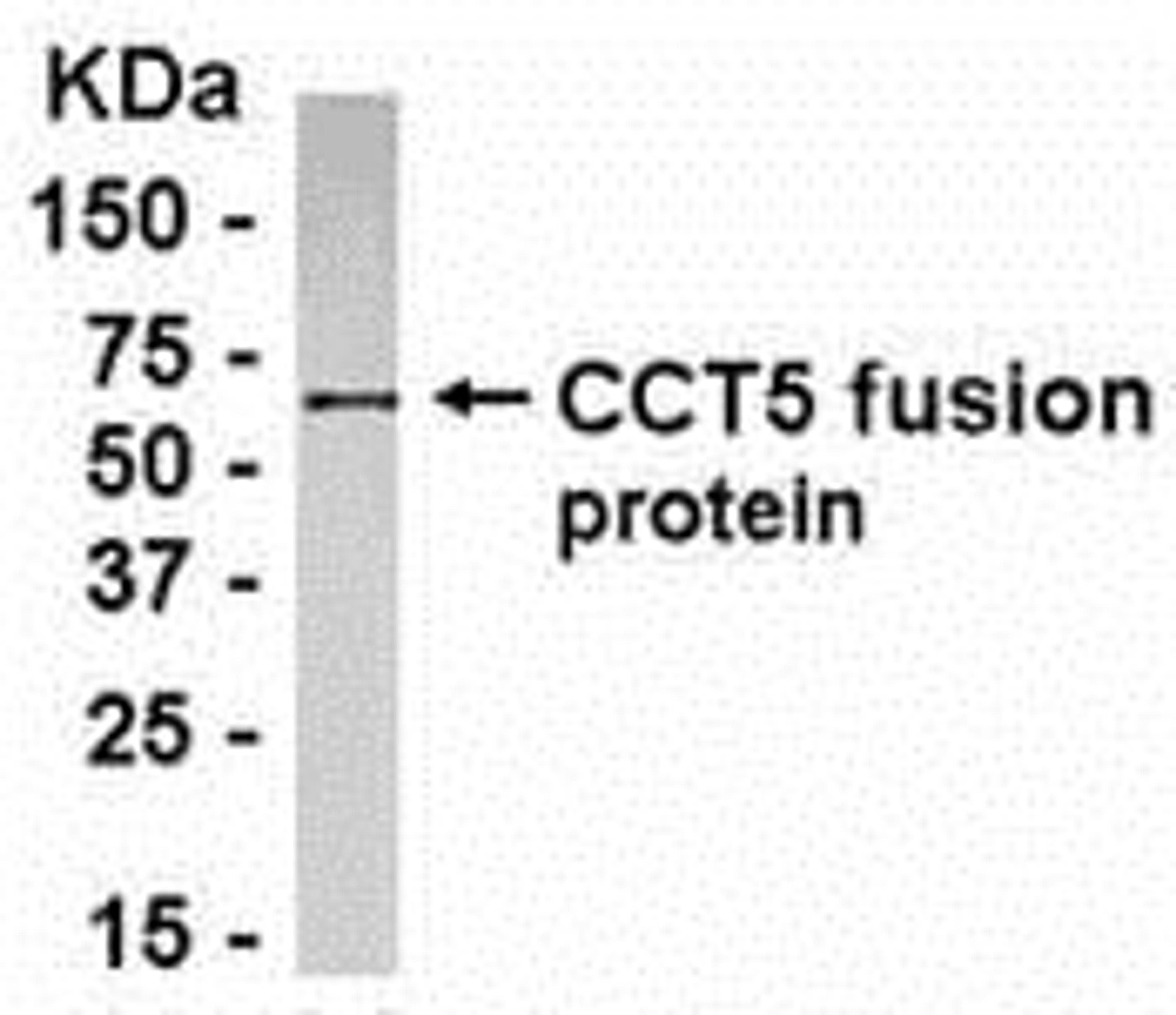 E coli-derived fusion protein as test antigen. Affinity-purified IgY dilution: 1:2000, Goat anti-IgY-HRP dilution: 1:1000. Colorimetric method for signal development.