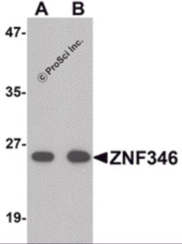 Western blot analysis of ZNF346 in human kidney tissue lysate with ZNF346 antibody (A) 0.5 and (B) 1 &#956;g/mL.