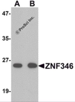 Western blot analysis of ZNF346 in human kidney tissue lysate with ZNF346 antibody (A) 0.5 and (B) 1 μg/mL.