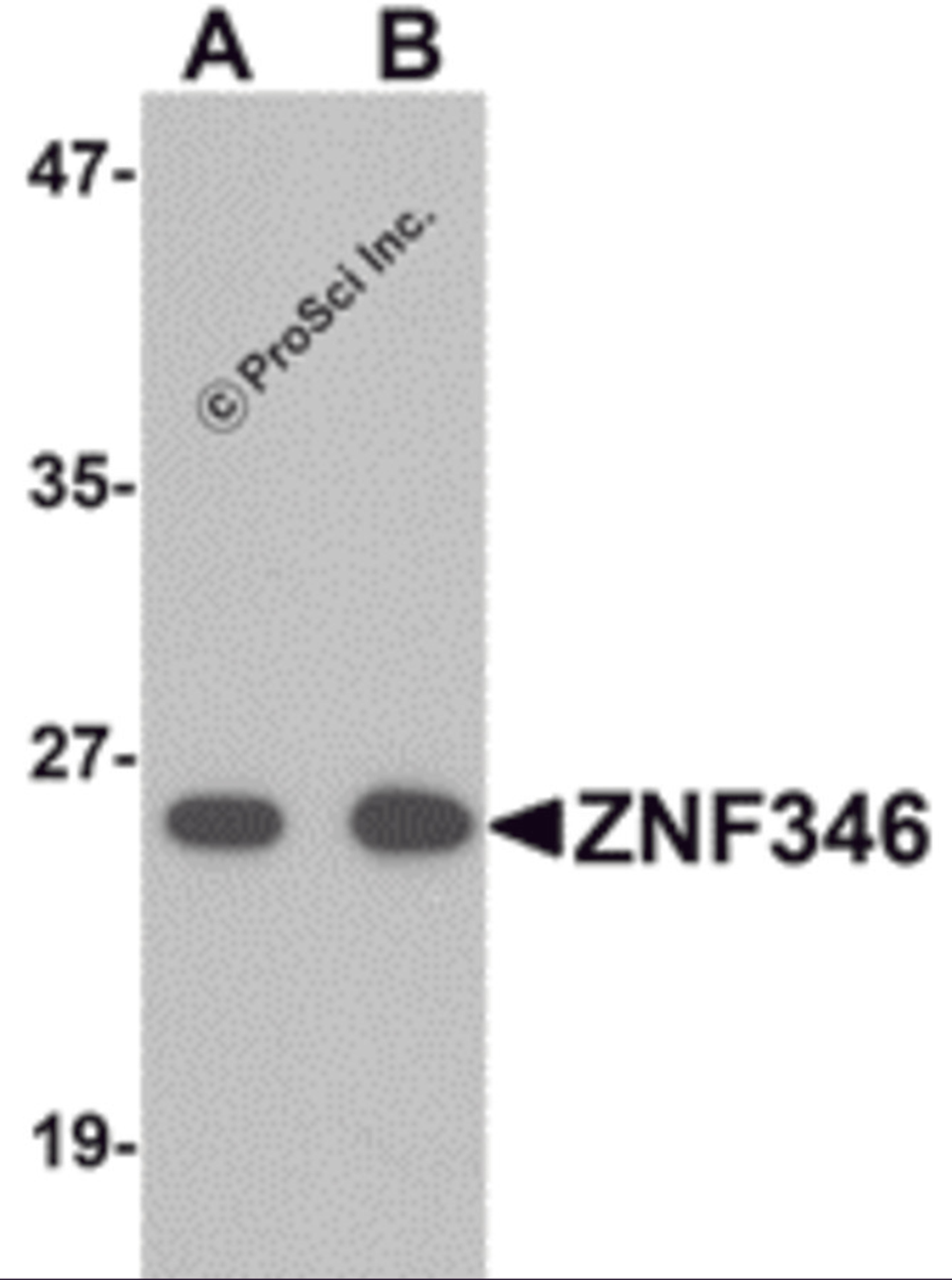 Western blot analysis of ZNF346 in human kidney tissue lysate with ZNF346 antibody (A) 0.5 and (B) 1 μg/mL.