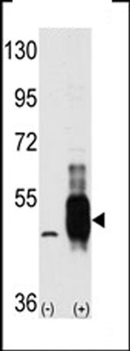 Western blot analysis of MEKK8 using MEKK8 Antibody using 293 cell lysates (2 ug/lane) either nontransfected (Lane 1) or transiently transfected with the MAP3K8 gene (Lane 2).