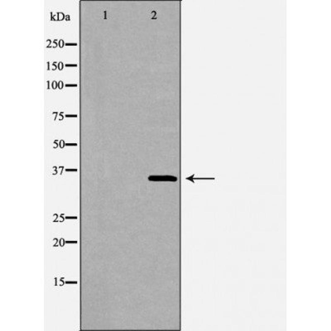 Western blot analysis of 293T cell lines using FCER2 antibody