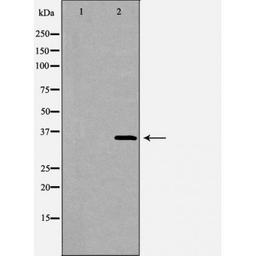 Western blot analysis of 293T cell lines using FCER2 antibody