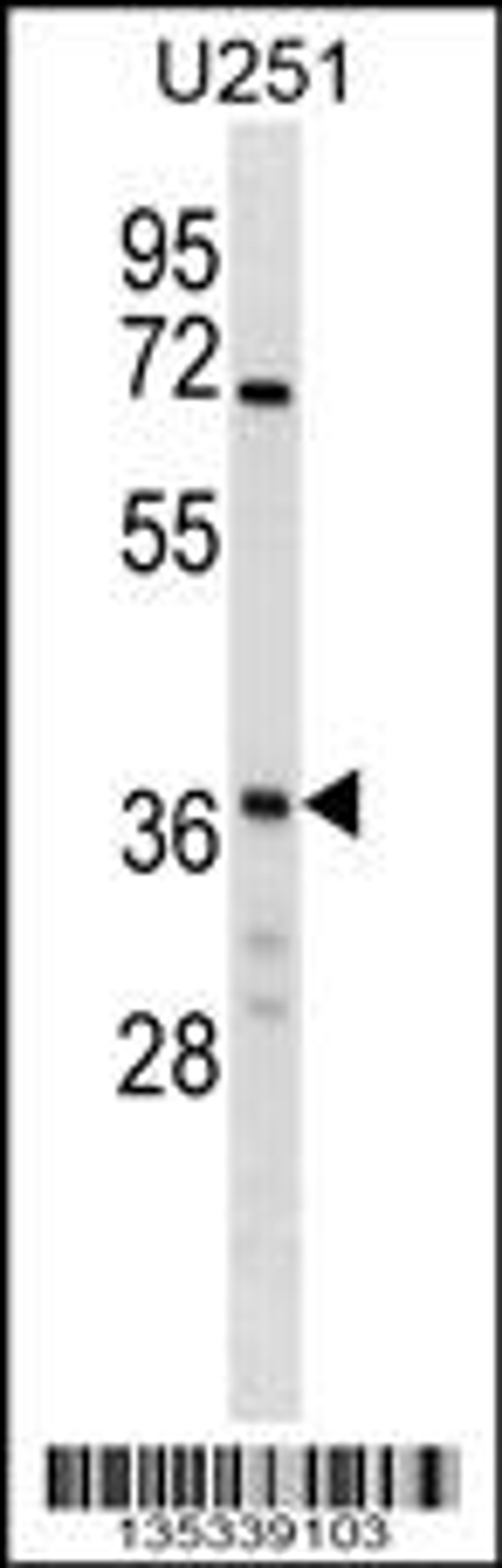 Western blot analysis in U251 cell line lysates (35ug/lane).