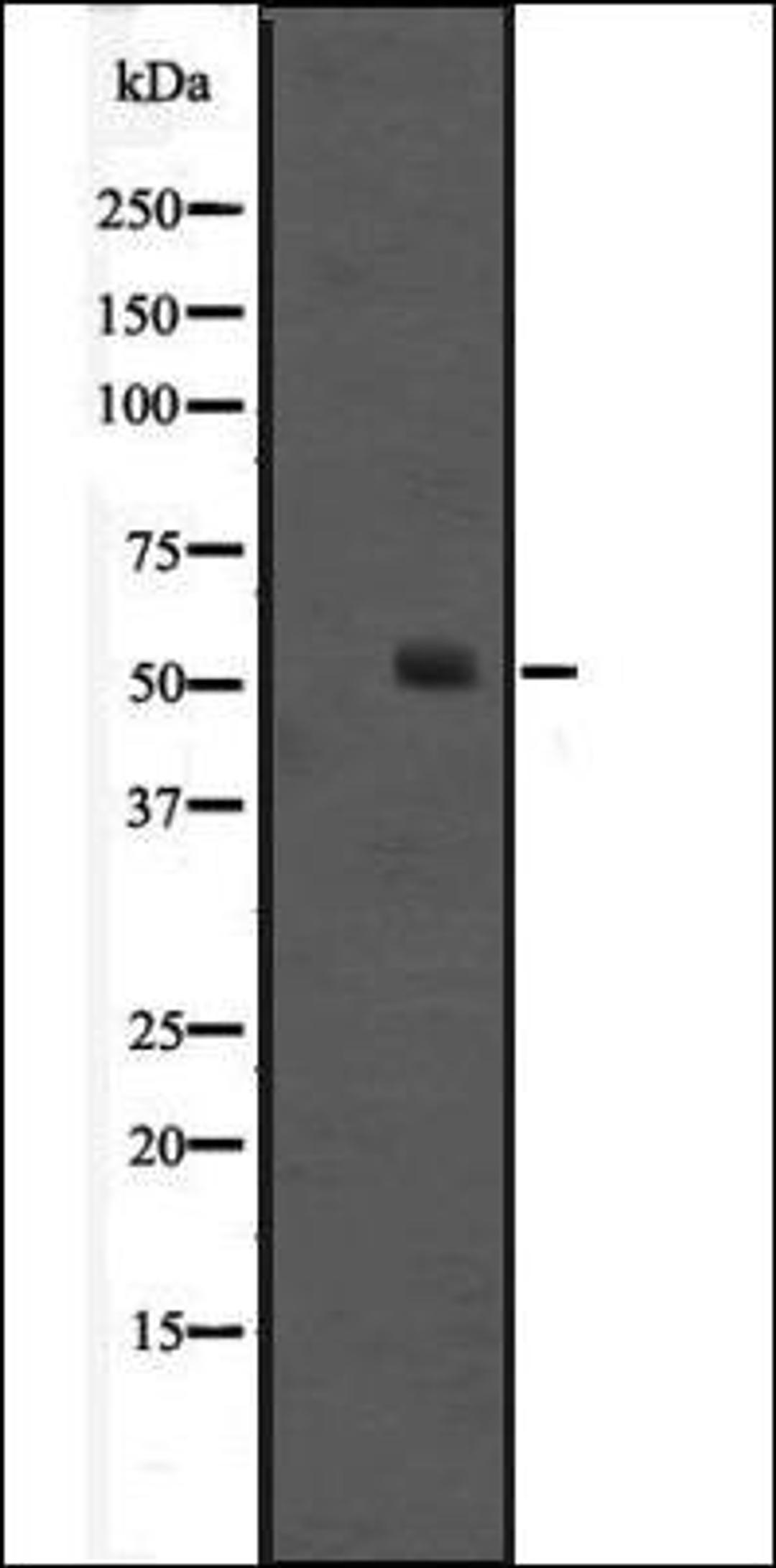 Western blot analysis of Jurkat cell lysate using HNF-6 antibody