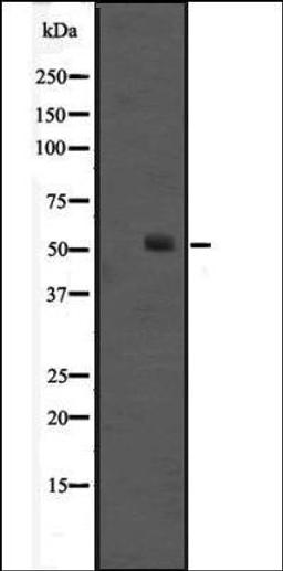 Western blot analysis of Jurkat cell lysate using HNF-6 antibody