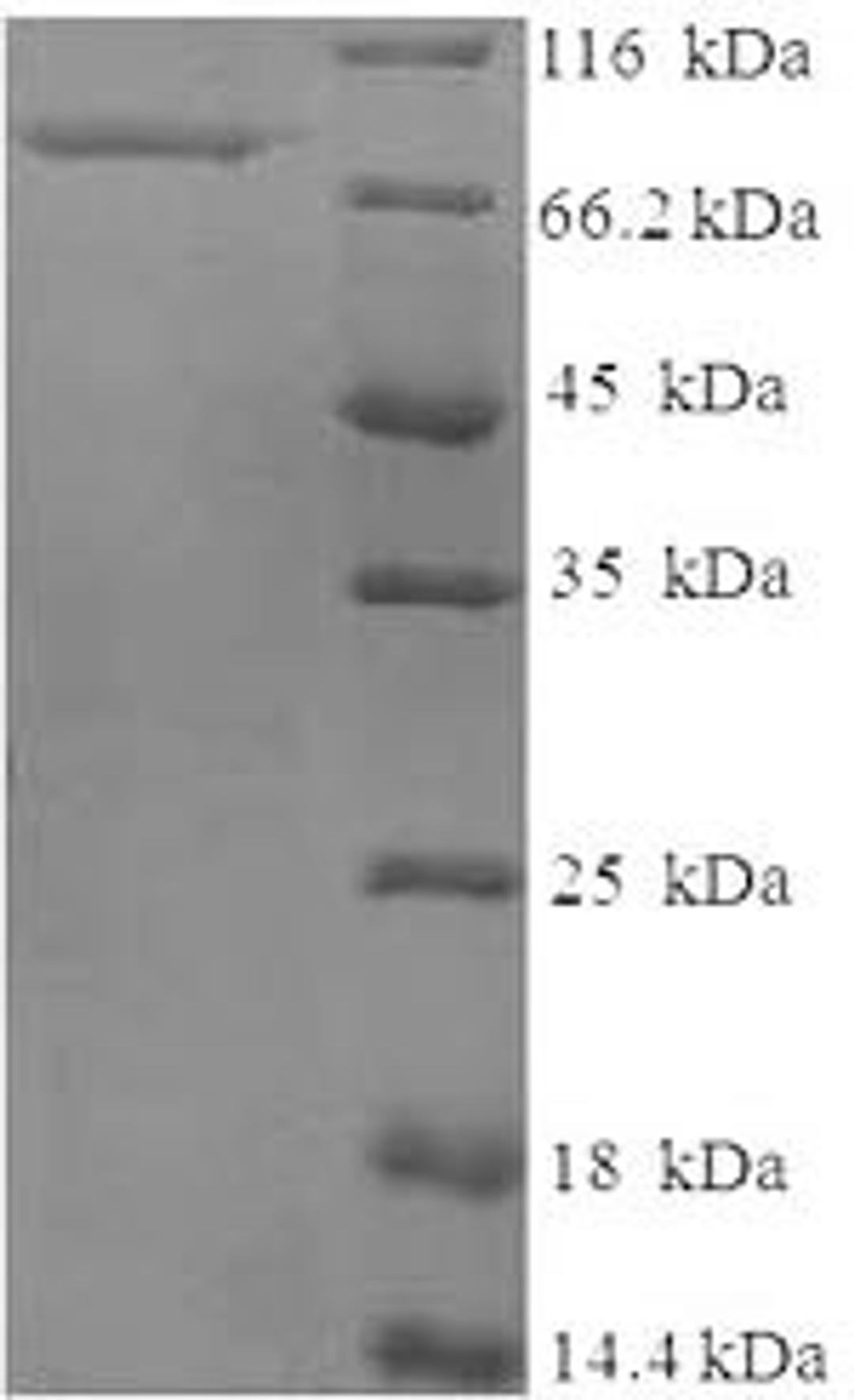 (Tris-Glycine gel) Discontinuous SDS-PAGE (reduced) with 5% enrichment gel and 15% separation gel.