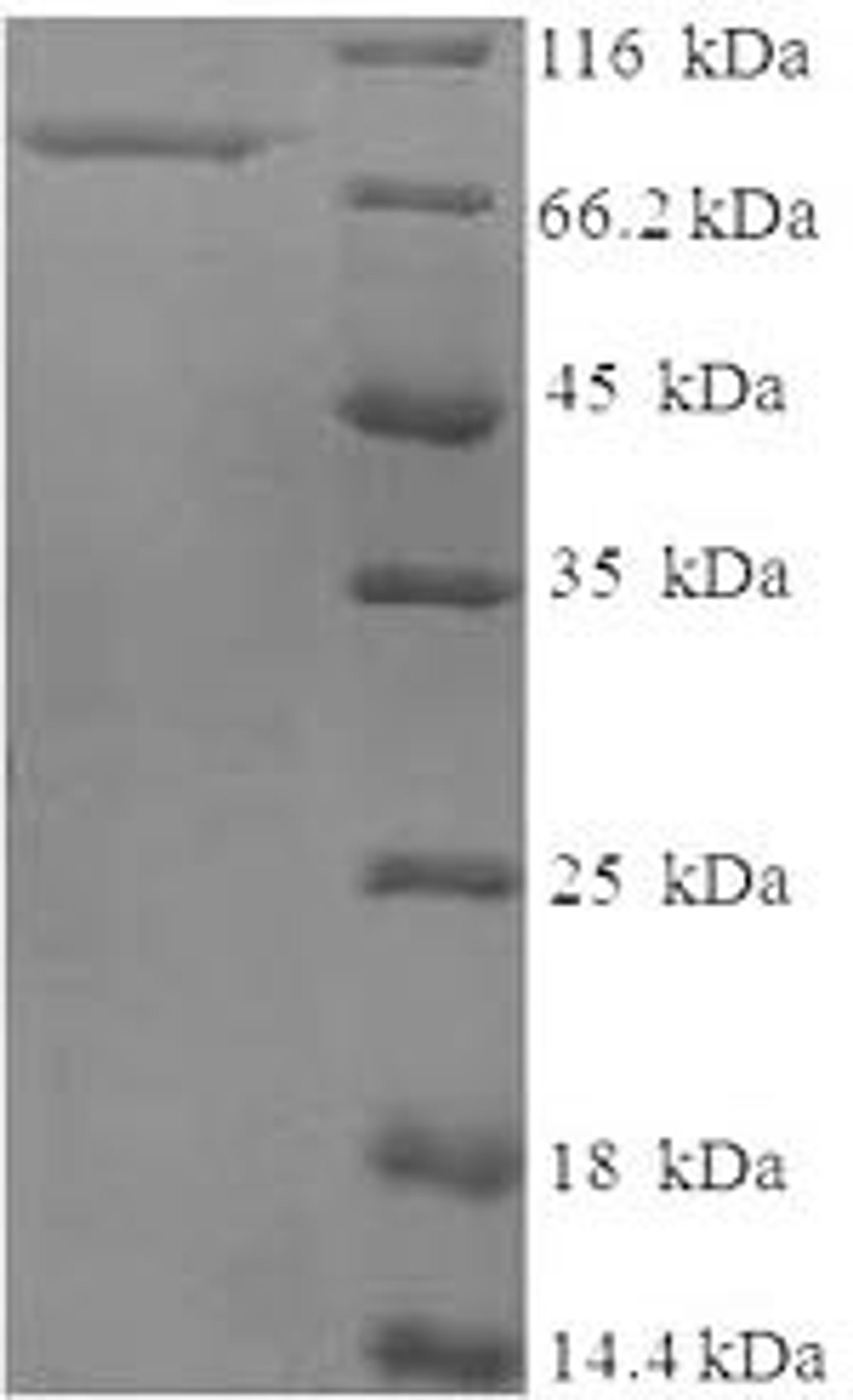 (Tris-Glycine gel) Discontinuous SDS-PAGE (reduced) with 5% enrichment gel and 15% separation gel.