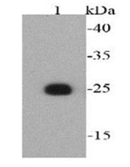 Western blot analysis of recombinant protein using T7 tag antibodyq