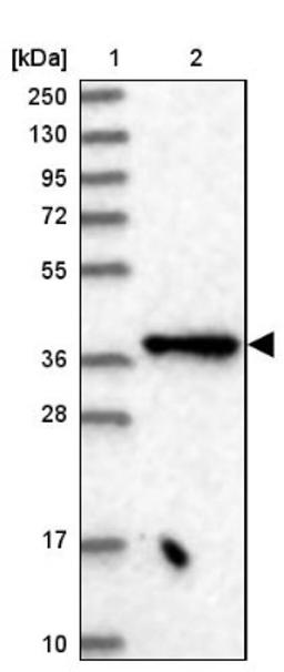 Western Blot: Elp4 Antibody [NBP2-47473] - Lane 1: Marker [kDa] 250, 130, 95, 72, 55, 36, 28, 17, 10.  Lane 2: Human cell line RT-4