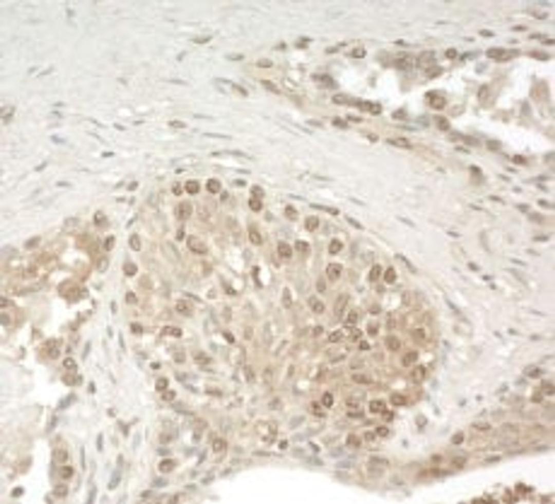 Detection of human ZCCHC11 by immunohistochemistry.