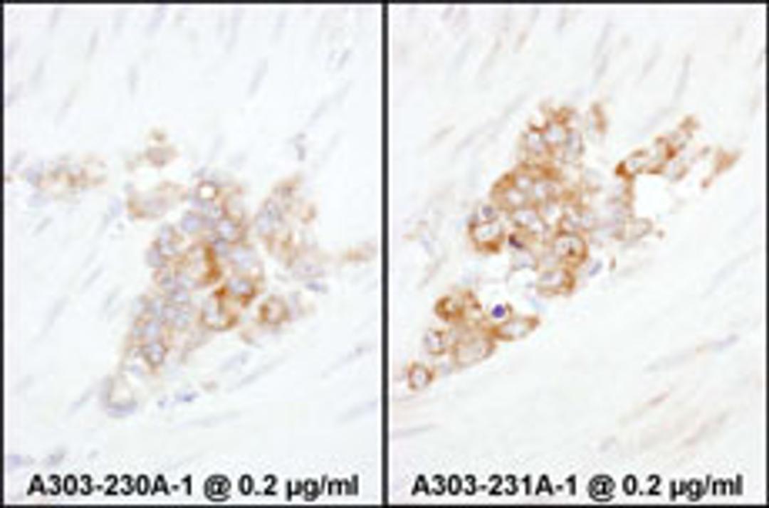 Detection of human YB1 by immunohistochemistry.