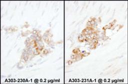 Detection of human YB1 by immunohistochemistry.