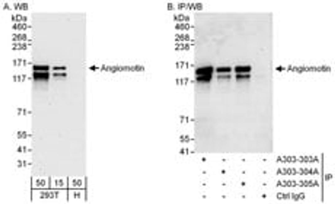 Detection of human Angiomotin by western blot and immunoprecipitation.