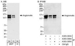 Detection of human Angiomotin by western blot and immunoprecipitation.