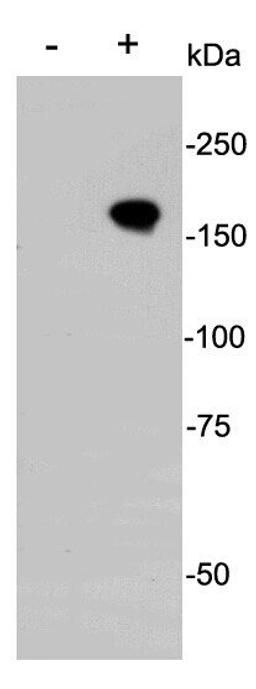 Western blot analysis of transfected 293 cells (+) and non transtected 293 cells (-) using CRISPR-Cas9 antibody