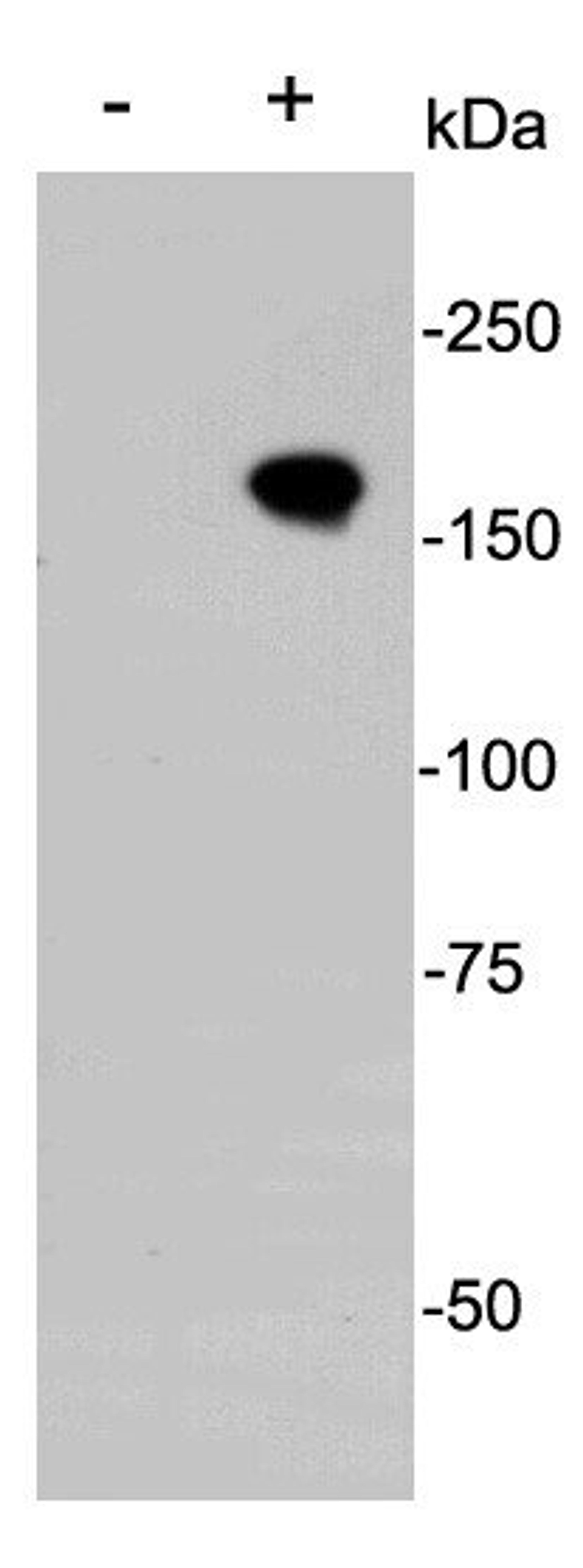 Western blot analysis of transfected 293 cells (+) and non transtected 293 cells (-) using CRISPR-Cas9 antibody