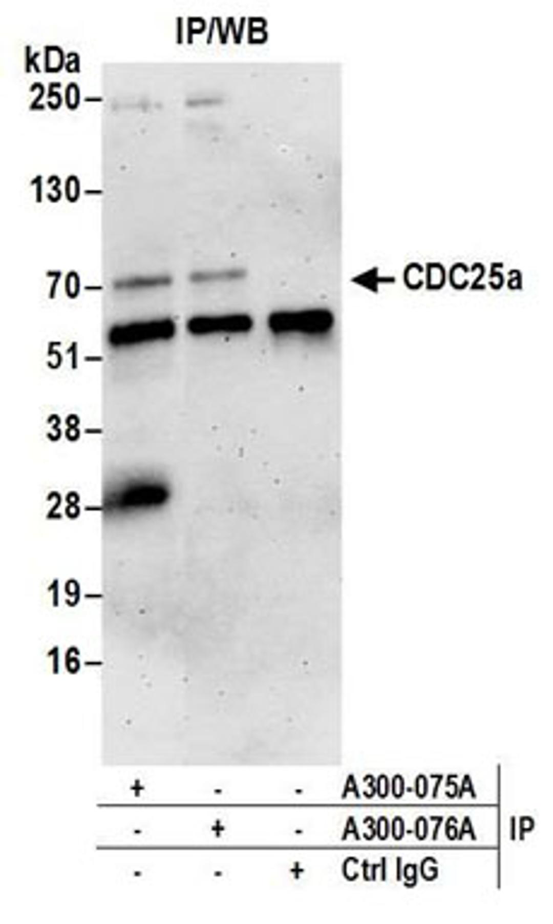 Detection of human CDC25a by western blot of immunoprecipitates.