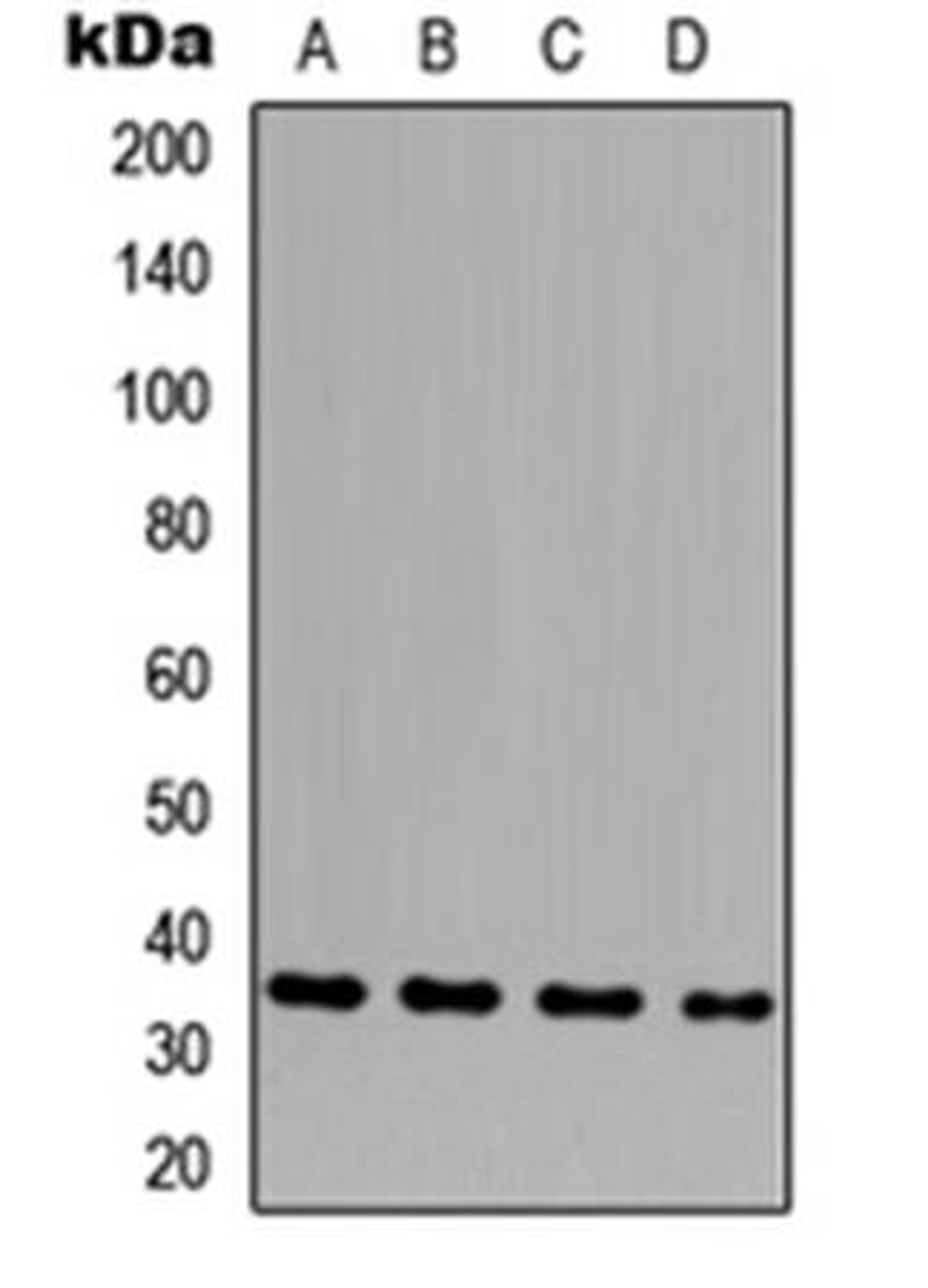 Western blot analysis of HeLa (Lane1), THP1 (Lane2), NS-1 (Lane3), H9C2 (Lane4) whole cell using GLB1L3 antibody