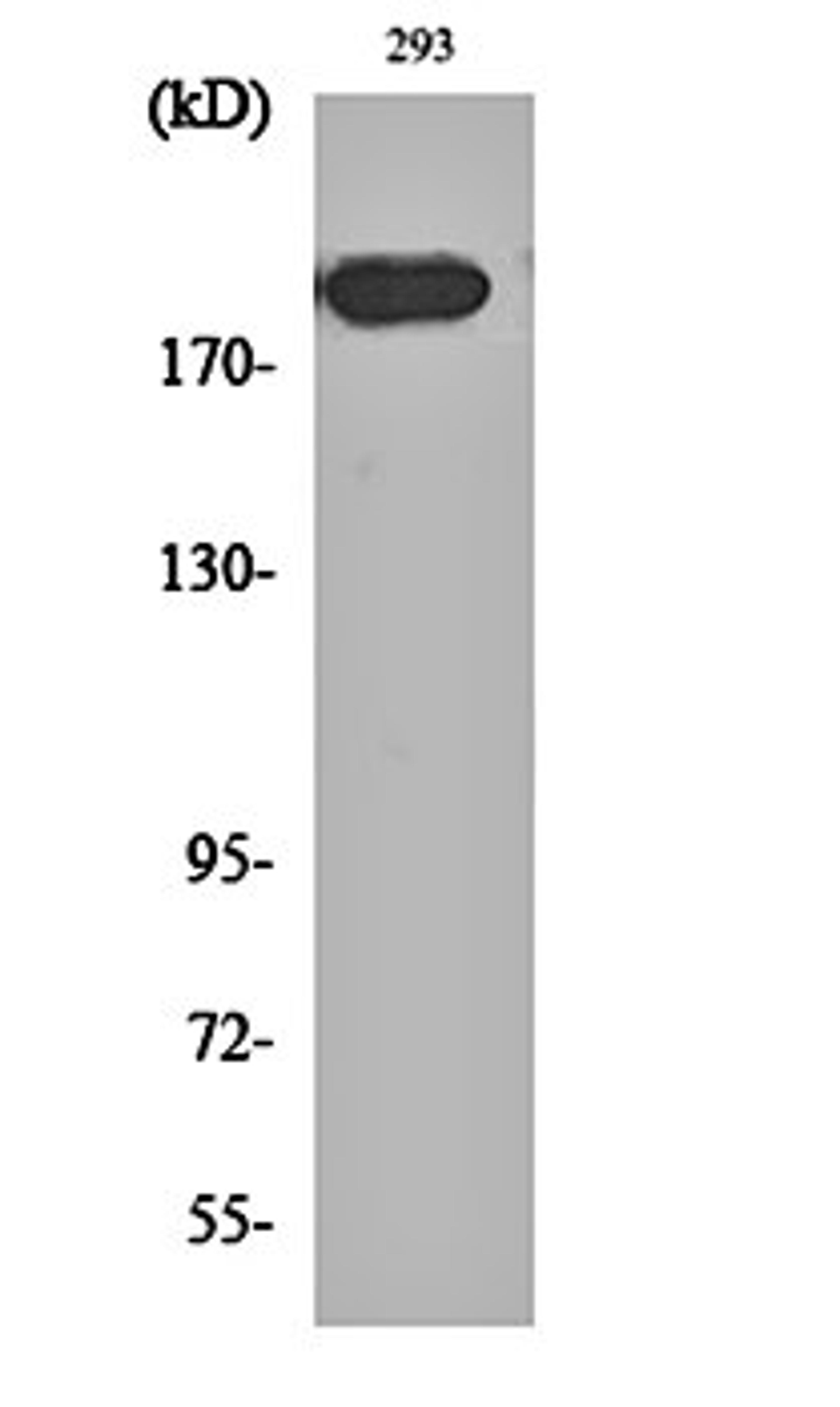 Western blot analysis of 293 cell lysates using Endo180 antibody