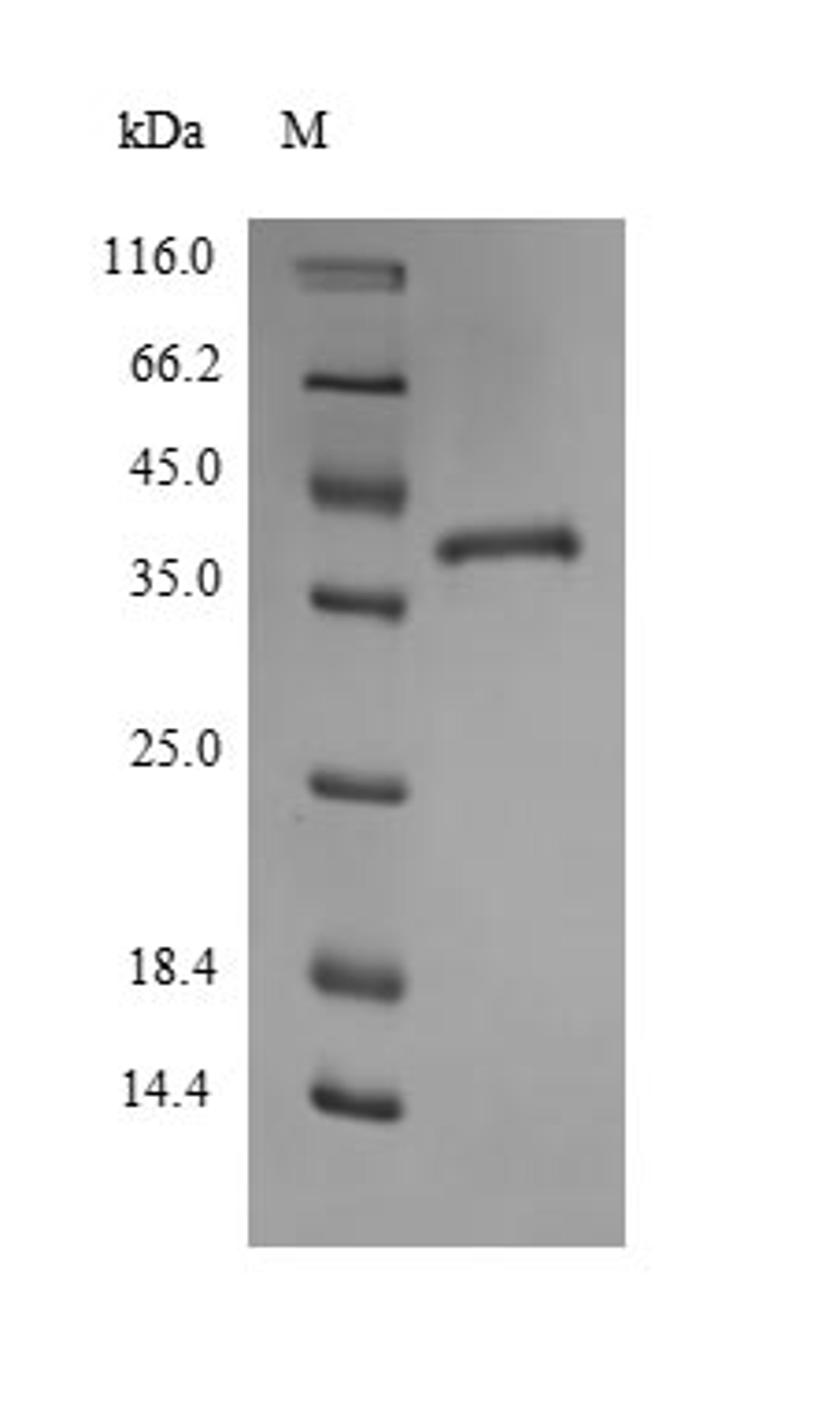 (Tris-Glycine gel) Discontinuous SDS-PAGE (reduced) with 5% enrichment gel and 15% separation gel.