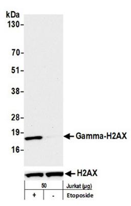 Detection of human Gamma-H2AX by western blot.