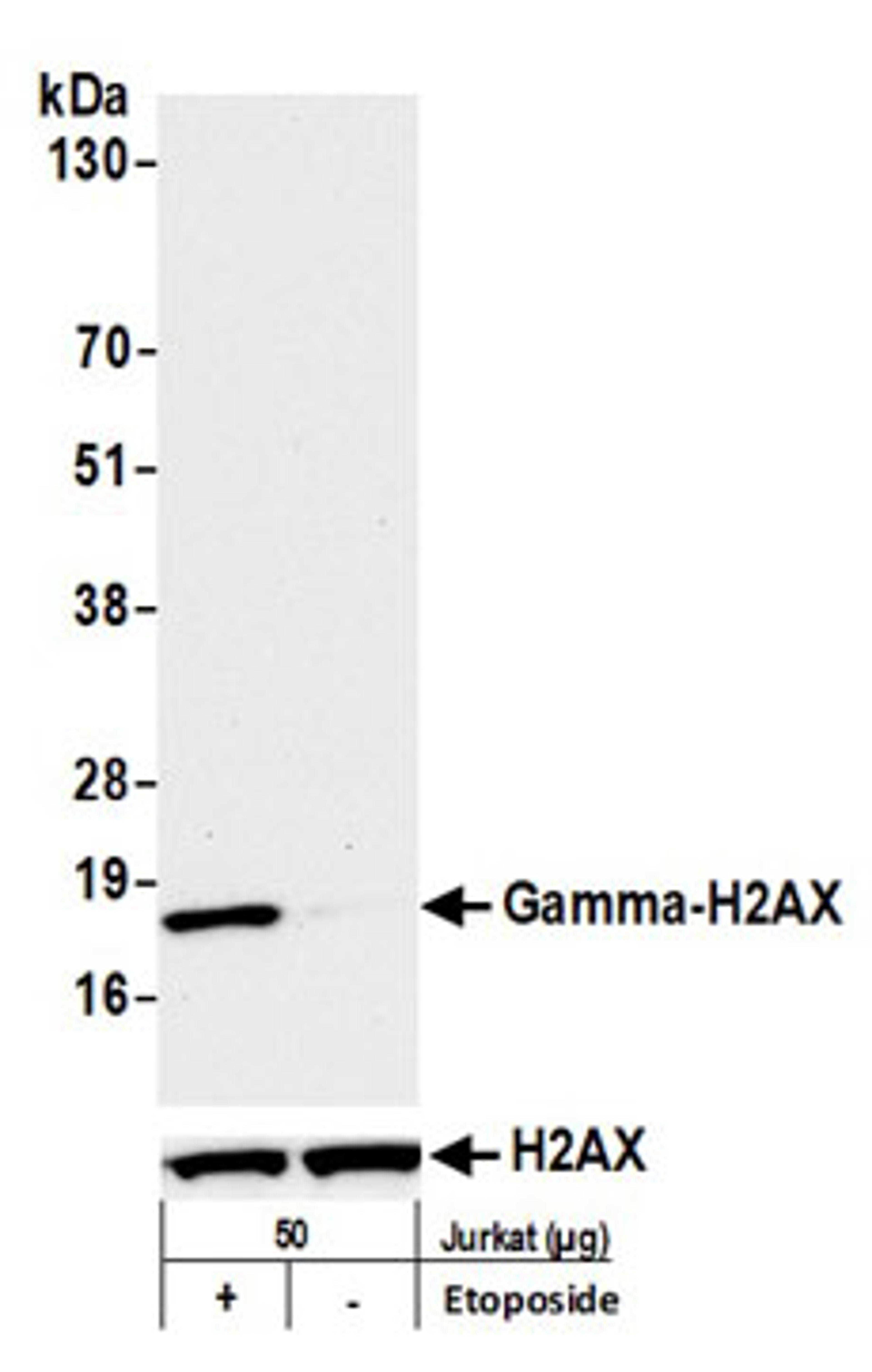 Detection of human Gamma-H2AX by western blot.